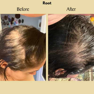 ROOT Natural Hair Growth Oil